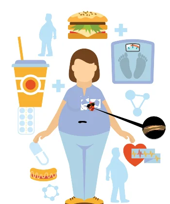 Heart disease in women: facts & statistics