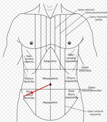 mesogastrium and iliac fossa drawing