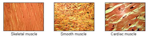 Figure 3 Types of Muscle Tissue