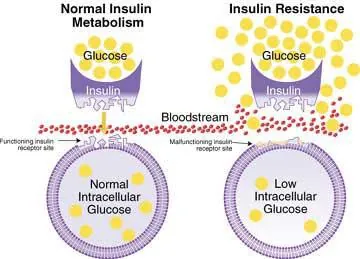 insulin resistance